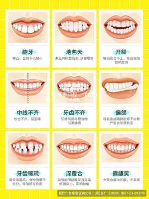 牙齿矫正方法有哪些（浙江康泰不锈钢制品厂）-图3